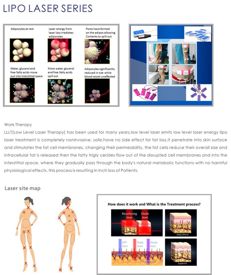 Multi-function Ultrasound Cavitation,Ultrasonic Cavitation Treatments,Ultrasound Cavitation Machine-Guangzhou OSANO Beauty Equipment Factory