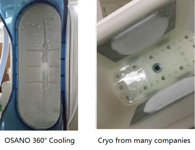 اشترِ معدات التخسيس الصغيرة المبتكرة المنزلية لتجميد الوزن وفقدان الوزن Cryolipolysis مع مقابض مزدوجة في Guangzhou OSANO Beauty Equipment Co.، Ltd.