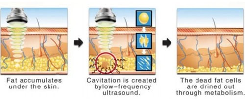 Multifunctionele echografie cavitatie, ultrasone cavitatiebehandelingen, echografie cavitatiemachine-Guangzhou OSANO Beauty Equipment Factory