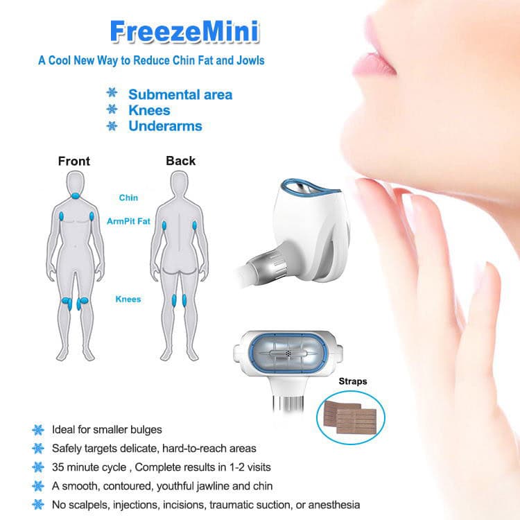 Diagram van de 360 draagbare cryotherapiemachine voor het verminderen van kin-, oksel- en knievet. Toont functies, behandelingsgebieden en apparaatdetails.