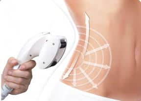 Professional Efficace Vacuum RF Mechanical Massage Anti Cellulite Machine