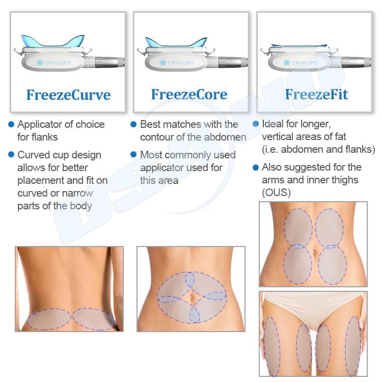 Innovative Cryolipolysis Device With Three Interchangeable Contours