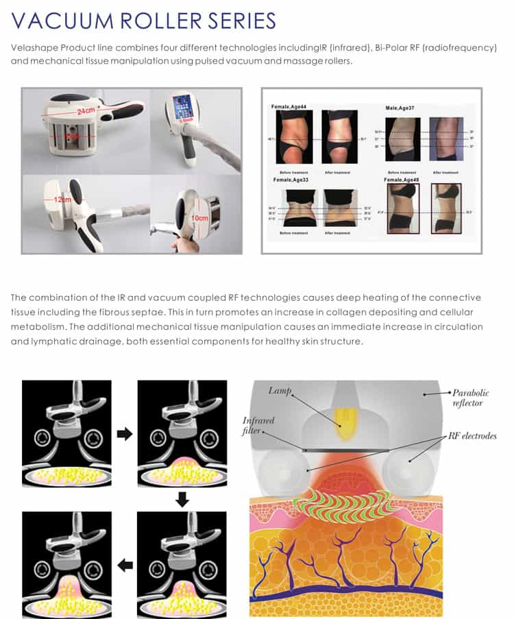 Monitoiminen ultraäänikavitaatio, ultraäänikavitaatiohoidot, ultraäänikavitaatiokone-Guangzhou OSANO Beauty Equipment Factory