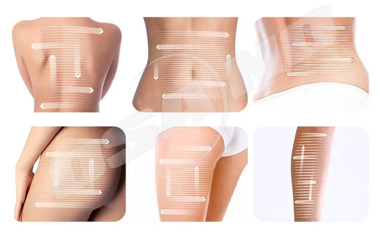 Buy Fastest Way Cellulite Remove Machine Home Beauty Device Vela Shape Frequency Radio RF Treatment At Guangzhou OSANO Beauty Equipment Co.,Ltd.