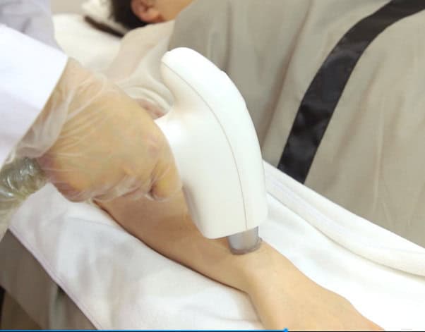 diode-laser-hair-removal-beautician-removes