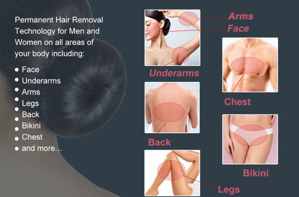 Sơ đồ minh họa phương pháp triệt lông cho nam và nữ bằng Máy triệt lông bằng tia laser diode Gold Standard 808.