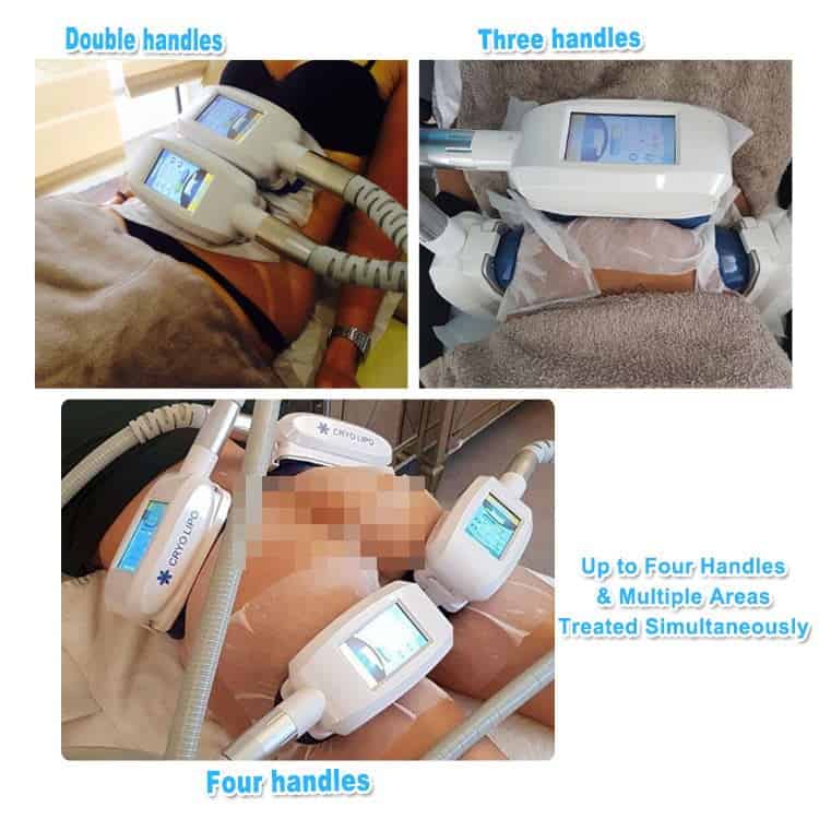 A series of pictures showing the use of a Best Home Equipment Full Body Cryotherapy Cryolipolysis Cellulite Loss Treatment Cryo Weight Loss Machine for weight loss.