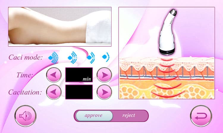 En kvindes krop vises på skærmen, der gennemgår ultralydskavitation Rf Radio Frequency Lipo Therapy Beauty Machine-behandling.