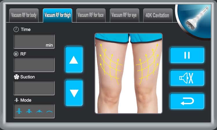 5M RF 적외선을 이용한 휴대용 Rf 캐비테이션 무선 주파수 치료 화면에 여성의 허벅지가 표시되어 있습니다.