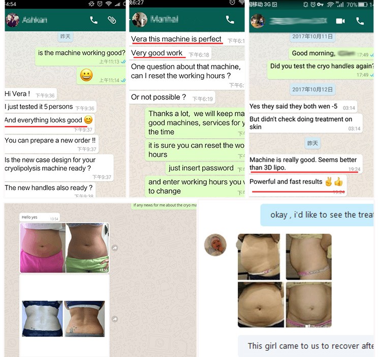 Een groep WhatsApp-berichten die de maag van een vrouw laten zien terwijl ze de nieuwe draagbare elektromagnetische schokgolf-cryotherapie DIY-schokgolftherapiemachine bespreekt.