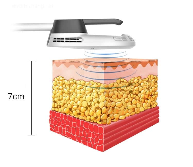 A diagram showing the dimensions of an Aesthetics Desktop 7 Tesla EMS Slimming Machine.