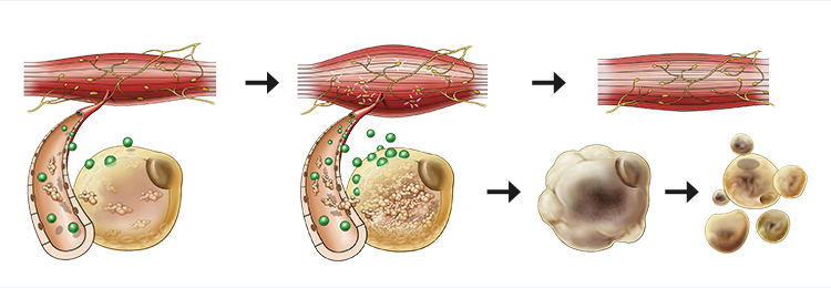 A diagram illustrating the various stages of a skin cell, aided by an Aesthetics Desktop 7 Tesla EMS Slimming Machine.