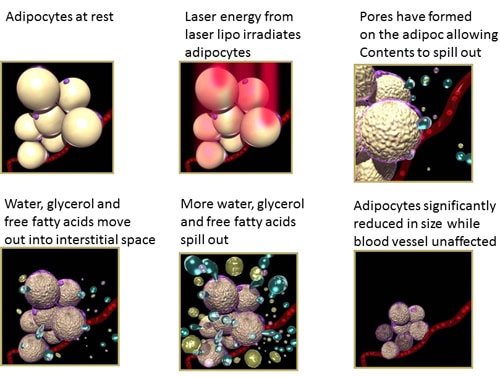 سلسلة من الصور تعرض أنواعًا مختلفة من الخلايا، مصحوبة بجهاز Slimming Beauty 6 in 1 لتحديد الجسم القوي.