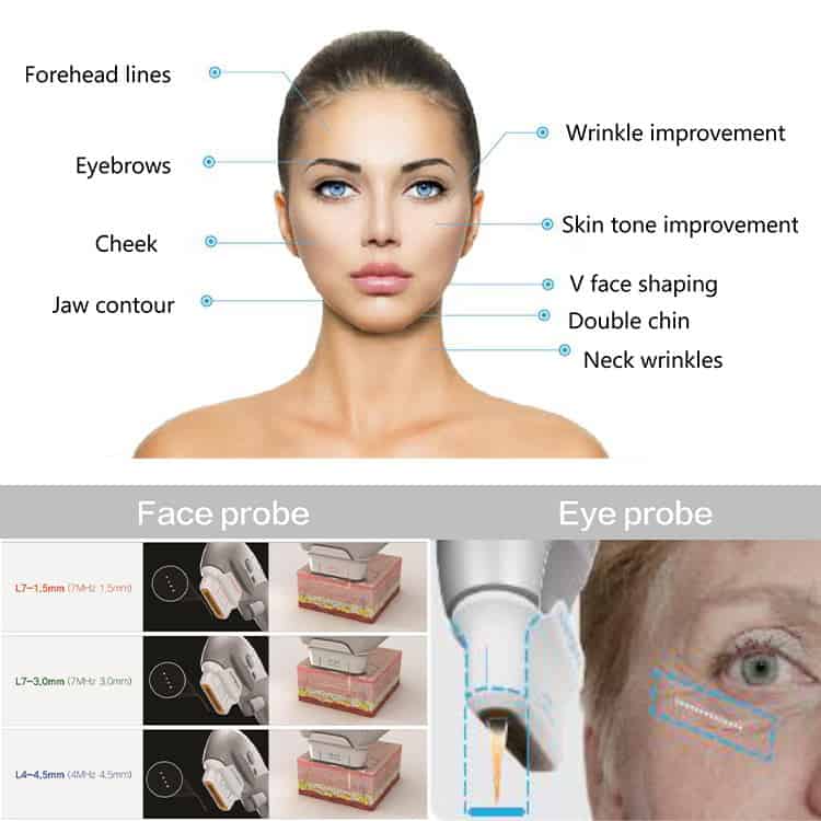 Uma imagem exibindo as várias partes do rosto de uma mulher, acompanhada por uma Mini Máquina Hifu Portátil Não Cirúrgica para Rosto e Corpo.