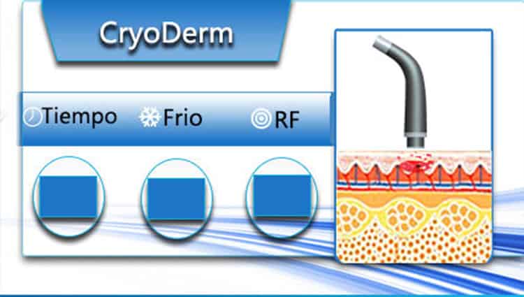 Профессиональная портативная радиочастотная процедура для лица Rf для кожи Tighten+Skin Firming - это портативное и профессиональное устройство, которое использует радиочастотную технологию для эффективных процедур по уходу за кожей.
