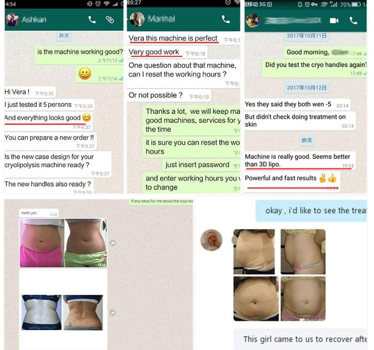 A collection of whatsapp messages showcasing the effectiveness of the Best Home Equipment Full Body Cryotherapy Cryolipolysis Cellulite Loss Treatment Cryo Weight Loss Machine in reducing cellulite on a woman's stomach.