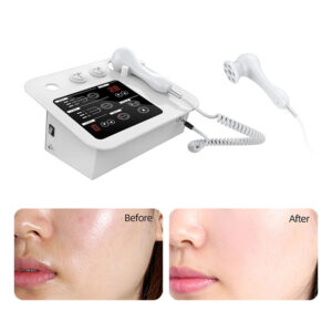 A woman's face is shown with a Portable 3 Handles Microcurrent Electroporation Mesotherapy Face Lifting Device Wrinkle Removal Machine and a phone.