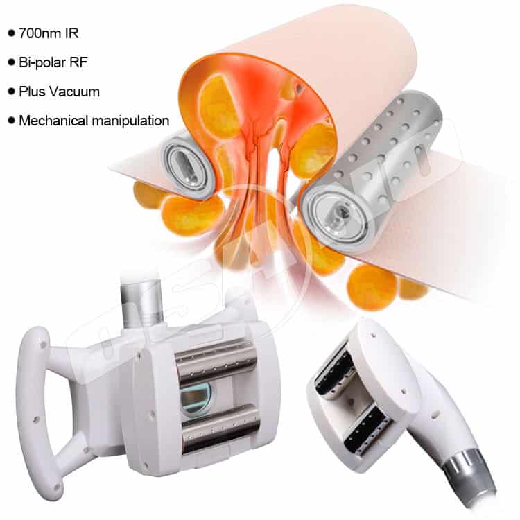 Une image d'une machine de beauté minceur pour l'élimination de la cellulite et du corps avec différentes pièces.