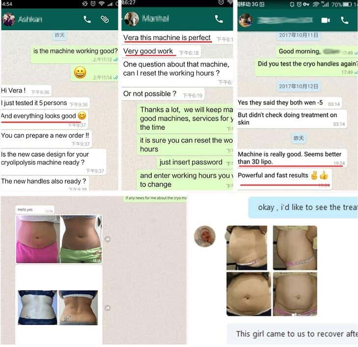 تظهر معدة المرأة النحيفة في رسالة WhatsApp على جهاز تجميل الجسم وإزالة السيلوليت.