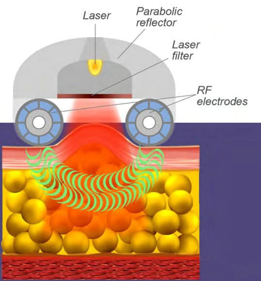 harnessing heating energy alongside mechanical massage