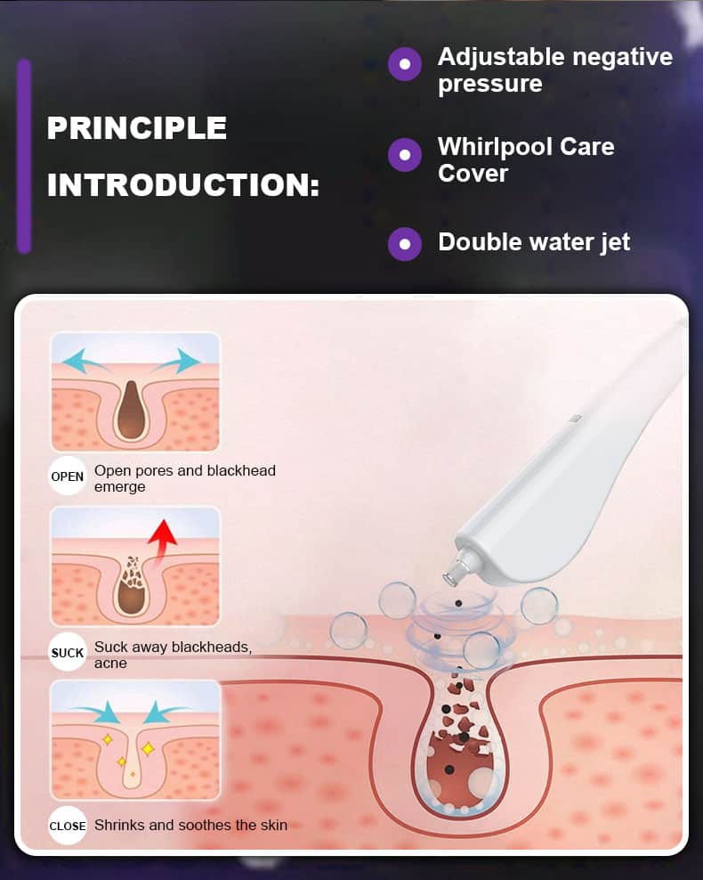 Ein Diagramm, das die Anwendung des Whirlpool-Pflegewassers mithilfe eines multifunktionalen Desktop-Geräts zur Mitesserentfernung für das Gesicht und zur Verjüngung der Hautpflege demonstriert.