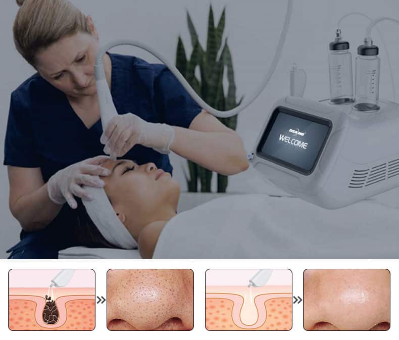 A woman is using the Desktop Facial Skin Blackhead Remover Machine Rejuvenation Multi-functional Skin Care Machine during her facial treatment.