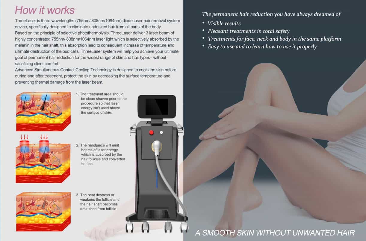 De benen van een vrouw ondergaan een pijnloze laser ontharingsbehandeling met een laser ontharingsapparaat met 3 in 1 golflengte 755 nm / 808 nm / 1064 nm pijnloze permanente diode laser ontharingsapparatuur.