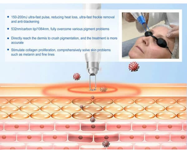 Tratamiento con láser Q Switch: Lo que necesita saber - OSANO
