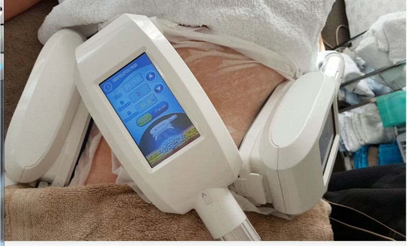 Considerações pós-tratamento