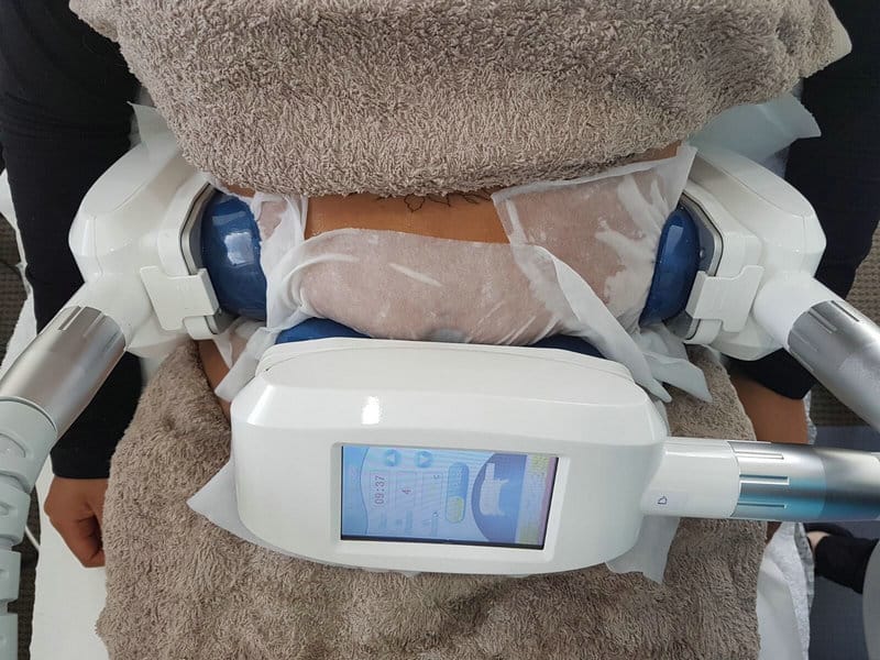 Er Cryolipolysis eller Coolsculpting smertefuldt