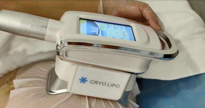 Vet bevriezen: DIY Coolsculpting of Cryolipolyse thuis? Absoluut niet