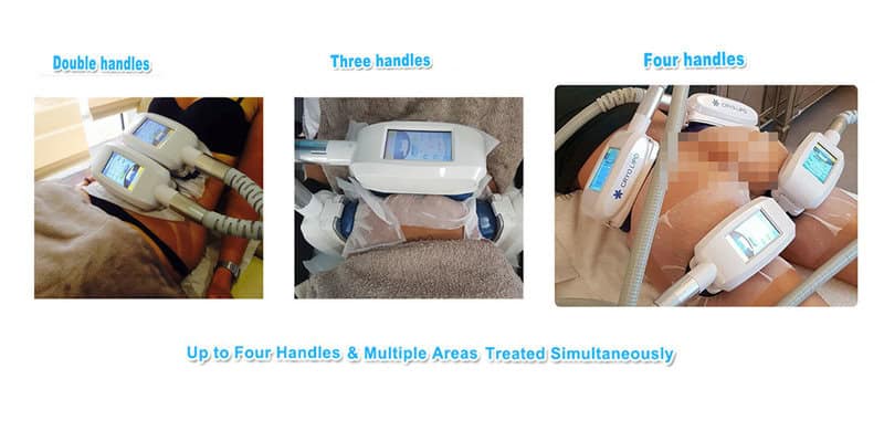 Procedimientos de bricolaje que no debes hacer: tratamiento con hielo en casa