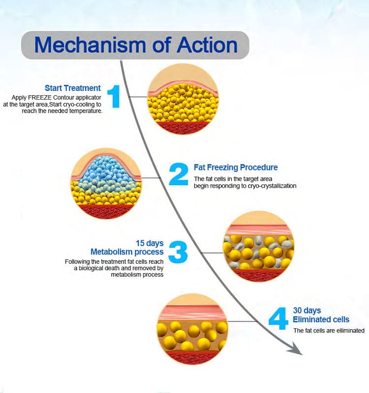 Diagram of New 4 handles BodySculpting Machine: Start, Fat Freezing (0 days), Metabolism (15 days), Cell Elimination (30 days).