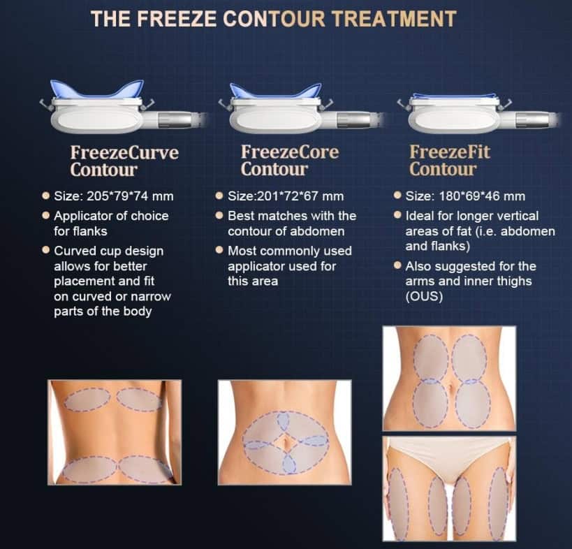 Infographic detailing three New 4 handles treatments: FreezeCurve (flanks), FreezeCore (abdomen/sides), and FreezeFit (arms/thighs). 