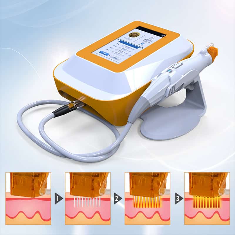 Máy vi kim RF Fractional dành cho các trung tâm thẩm mỹ có màn hình kỹ thuật số và đầu kim, với sơ đồ hiển thị quá trình trẻ hóa.