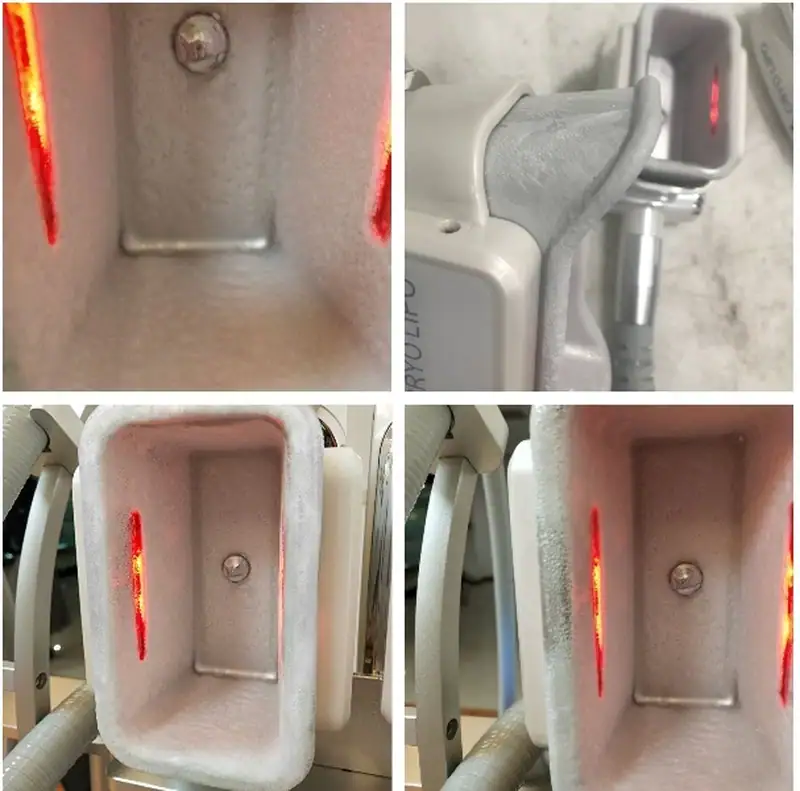 Close-up images of the OSANO Freeze Contour MAX CoolSculpting machine showing the applicator and cooling chamber with red LED lights.