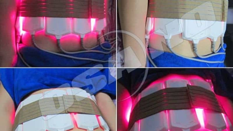 Une personne en chemise bleue subit une liposuccion au laser, avec des électrodes de lumière rouge sur le torse. Quatre images montrent le processus de ciblage de la graisse, sûr et respectueux des organes.