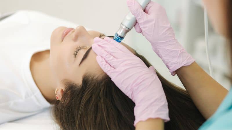 Vaaleanpunaisissa käsineissä oleva henkilö suorittaa laitteella HydraFacial-hoidon naisen otsalle hänen makaaessaan silmät kiinni.