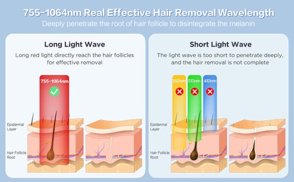 Osano portable 808nm diode laser machine for effective hair removal, featuring advanced technology for safe and efficient hair reduction at home or in clinics.