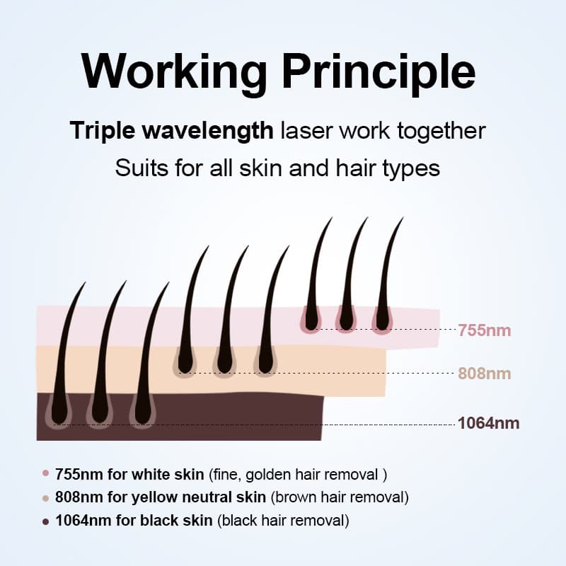 Diagram över hårborttagningsmaskin med isdiodlaser med trippelvåglängder för alla hudtoner, inriktad på folliklar på olika djup.