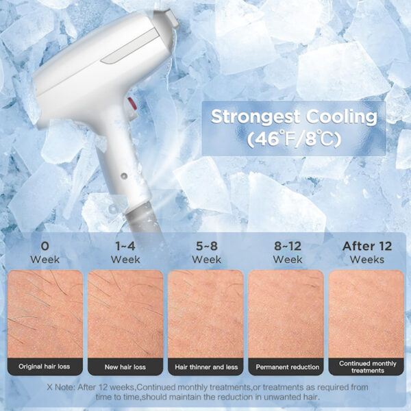 808nm Ice Diode Laser Hair Removal Machine for Sale