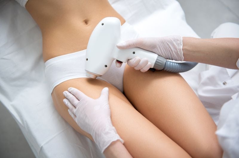 Laser hair removal procedure on a woman’s thigh, performed by a professional with a handheld device, emphasizing safe, effective, and modern skincare solutions.