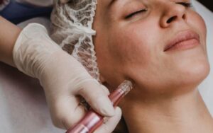 Woman receiving Ultherapy non-surgical skin lifting and tightening treatment on her face, performed by a professional in a clinical setting.