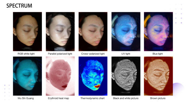 Advanced multispectral skin imaging technology for detailed analysis.