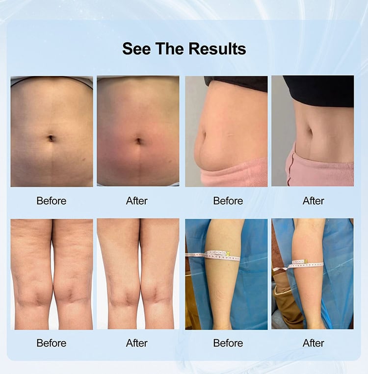 Comparison images showing body transformation results, including weight loss and skin tightening, highlighting effective health and fitness improvements.