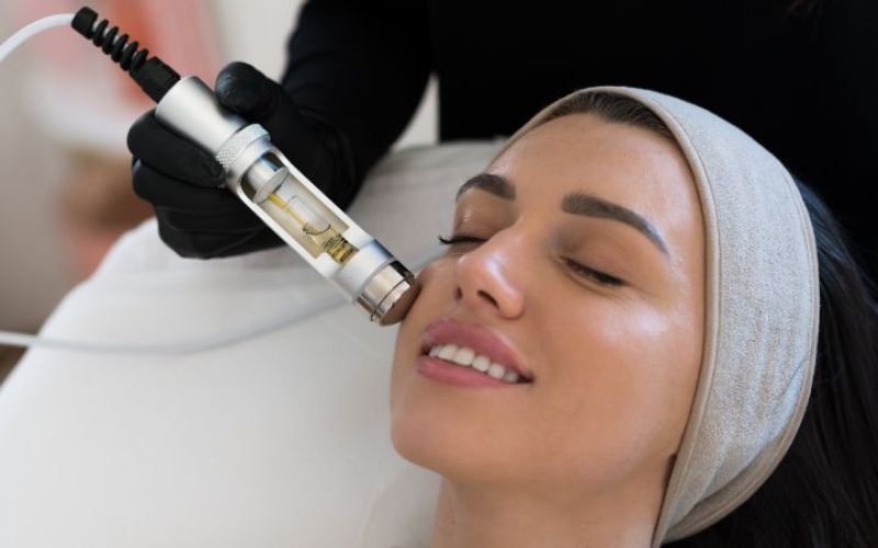 Woman receiving oxygen facial treatment with a professional device, highlighting skincare and facial rejuvenation benefits.