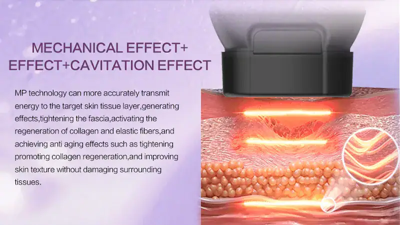Close-up of the OSANO 7D Pro MFU & HIFU machine demonstrating skin treatment with visual effects showing energy transfer to skin tissue.