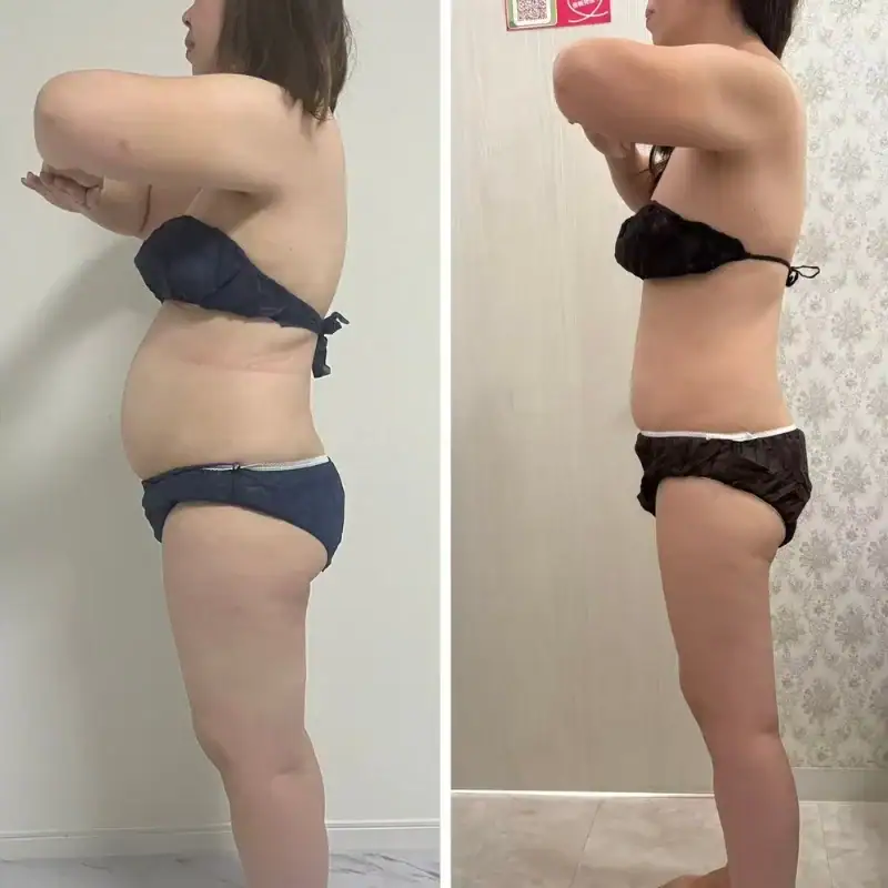 Side-by-side comparison of a woman's weight loss journey showing significant body transformation.