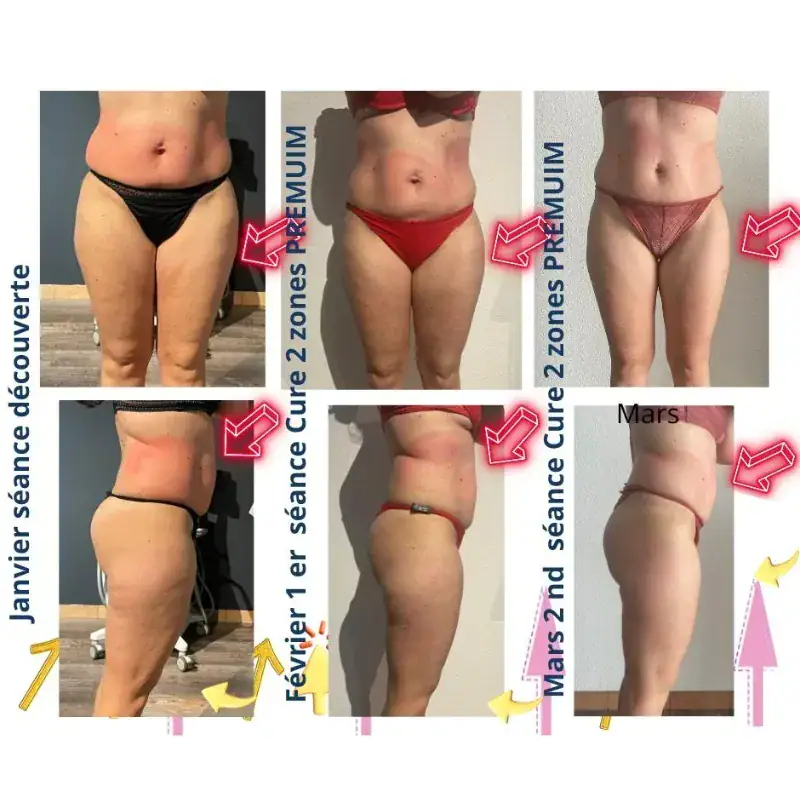 Series of before and after photos showing body transformation over several months with marked progress in weight loss and toning.