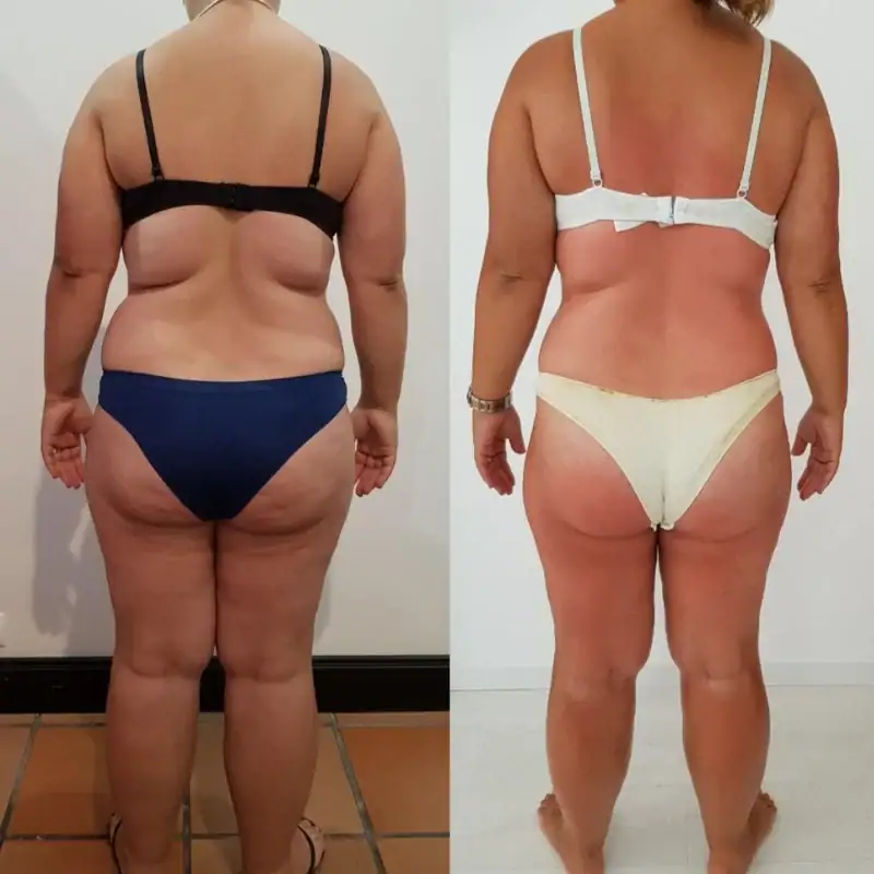 Side-by-side comparison of a woman's weight loss journey showing significant body transformation from back view.